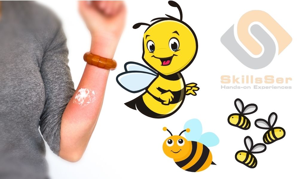 First aid for bee stings